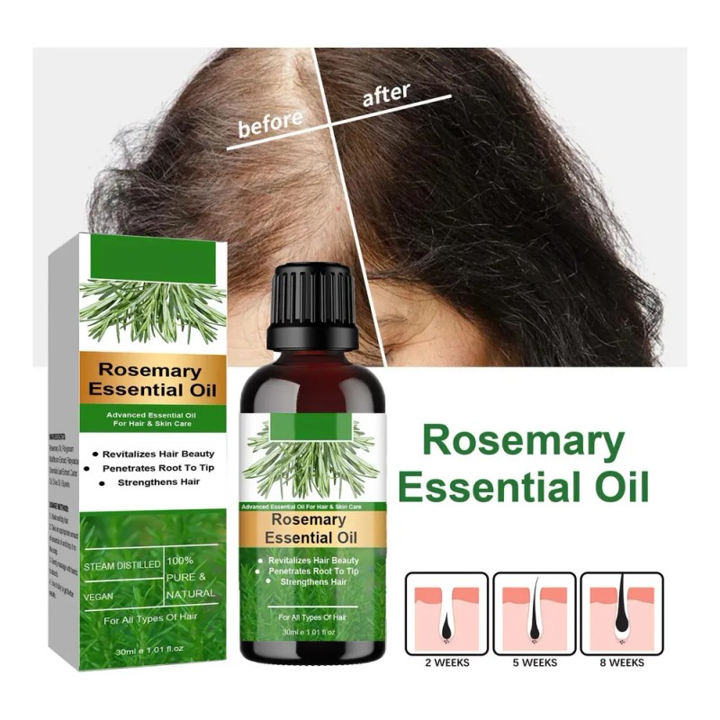 Aceite Capilar De Romero Para Fortalecer El Cuero Cabelludo,