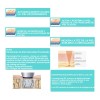 KEMETVOV Minihifu Facial Corporal+masajeado Cuello Papada Lifting+gel
