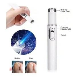 Bolígrafo Láser Hot Nail Fungus Pen Con Luz Azul