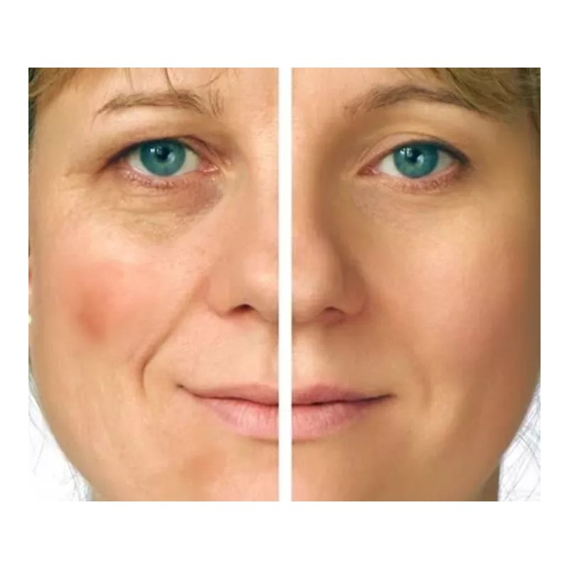 Caviar Serum Crema Caviar Regenera Ojera Arruga 100% Original 100ml