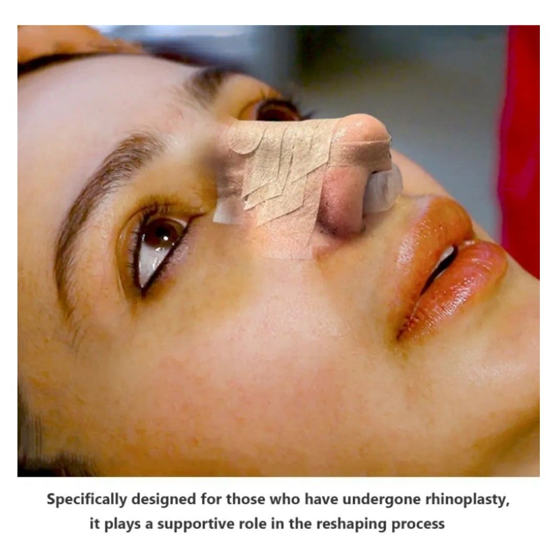 Kit Férula Doyle Nasales Médica Termoplásticas Rinoplastia Transparente