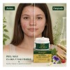 Crema Herbal Tratamiento Acné, Control Grasa, Minimiza Poros