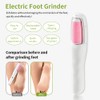 SIYDYRIT 2 in 1 Electric Callus Remover for Feet &