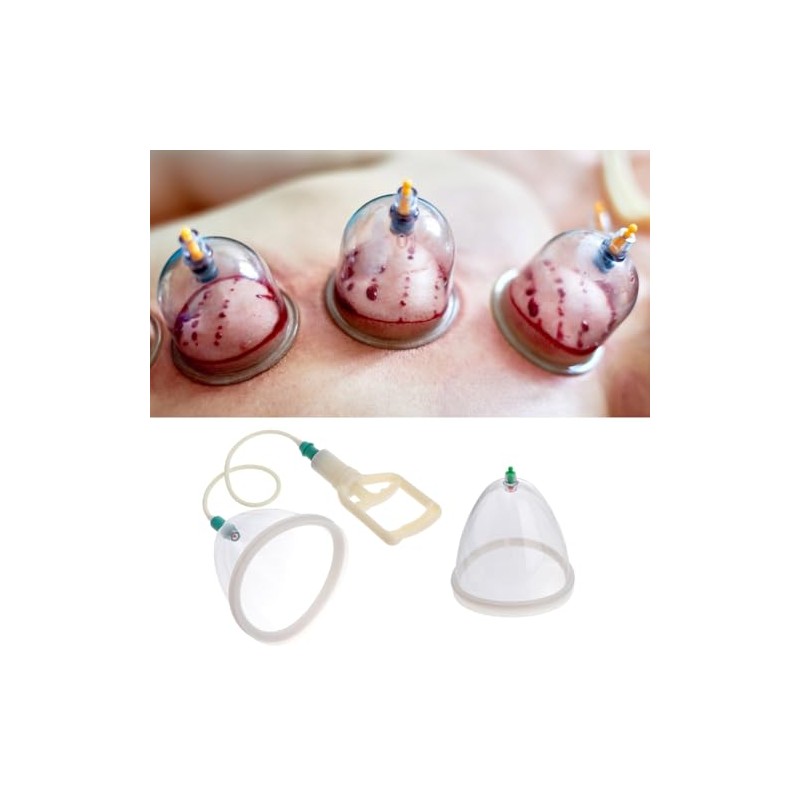 COLLBATH COLLBATH 2pcs Negative Pressure Massage Cups for Cupping Therapy