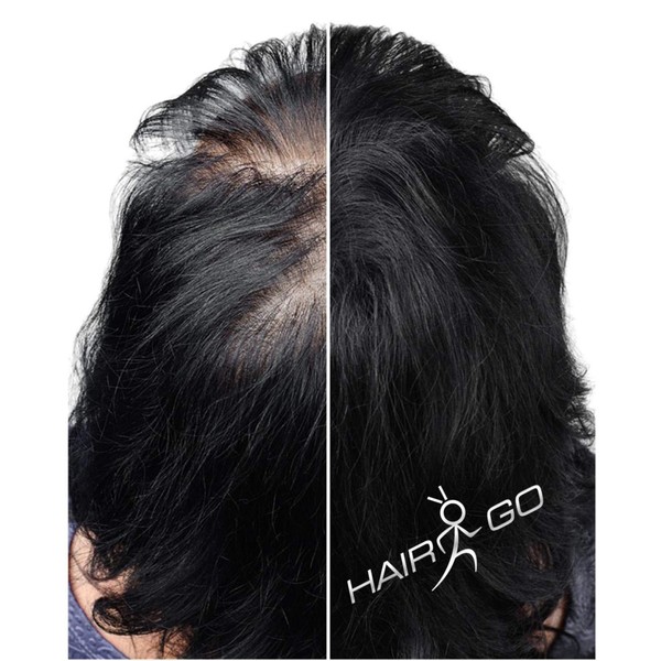 HAIR GO Premium Hair Thickening | Hair Powder | Scatter Hair | Hair Filler | Hair Loss | Hair Thickener 100% Natural & Vegan, Pack of 1 (1 x 25 g) (Dark Blonde)