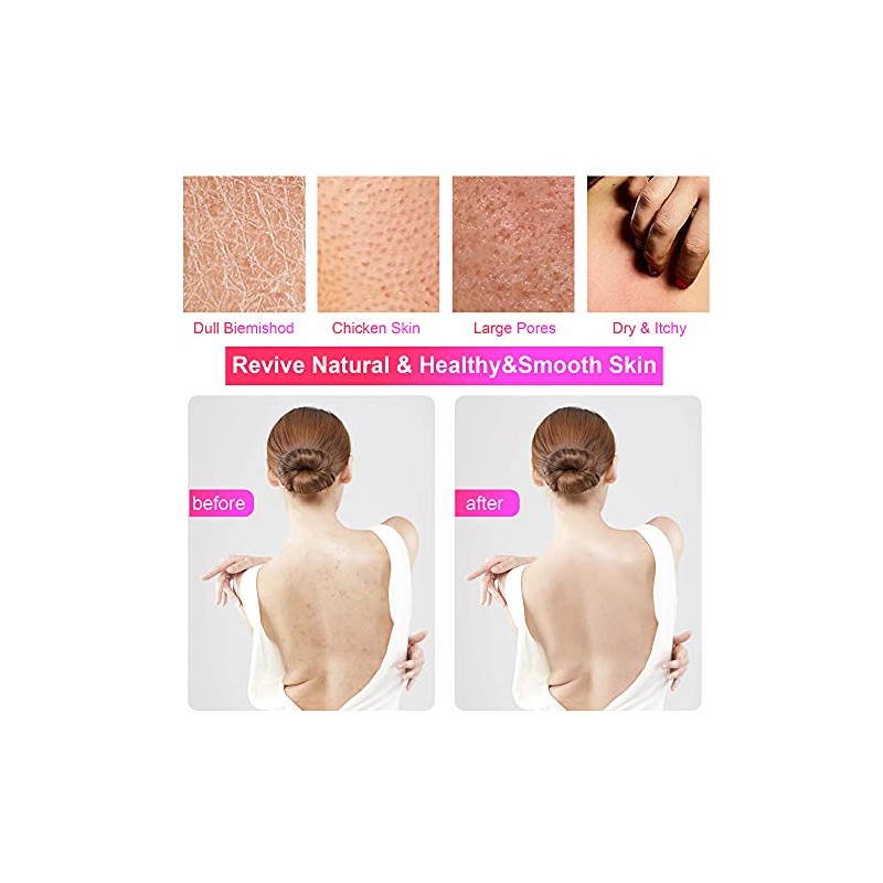 Máxima exfoliación y confort con niolio