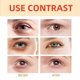 Eyelift Serum Mango Revitalize Eye Cream,eye cream for dark circles and puffy eyes,Hyaluronic Acid Repair Cream,eye bag crea-m,Wrinkles Eye Creams Oil Essence Firming Crea-m,eye tightening cre-am