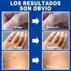 Líquida De Eliminación De Verrugas Y Mezquinos
