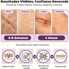 Parches de Silicona para Cicatrices 1.5M - Reducción Visible y