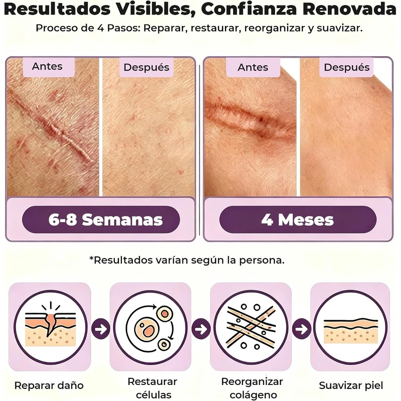 Parches de Silicona para Cicatrices 1.5M - Reducción Visible y