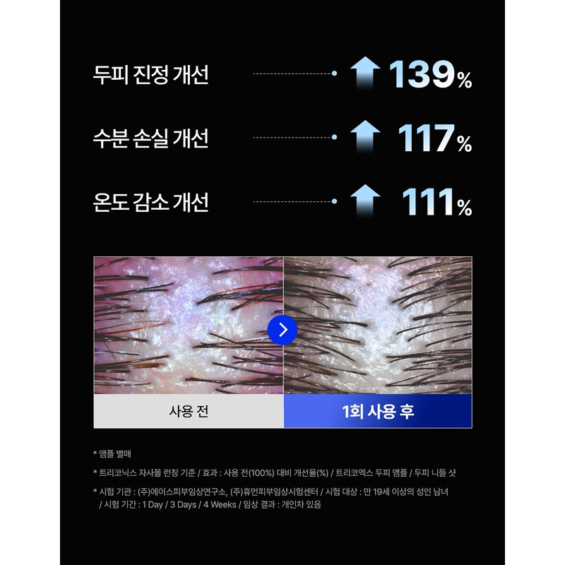Triconics Triconix Scalp Needle Shot Refill (10p) / 트리코닉스 두피