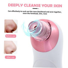 FRCOLOR 1set Skincare Electric Vacuum Blackhead Remover Compact Safe Material for Pore Cleaning