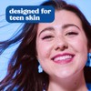 JJ Persa-Gel Acne Tr MS Size 1z Clean Clear Maximum