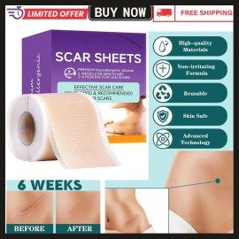 Unbranded Silicone Scar Sheets,(1.6" X 60" Roll-1.5M) Silicone Scar Tape for Surgical Scar