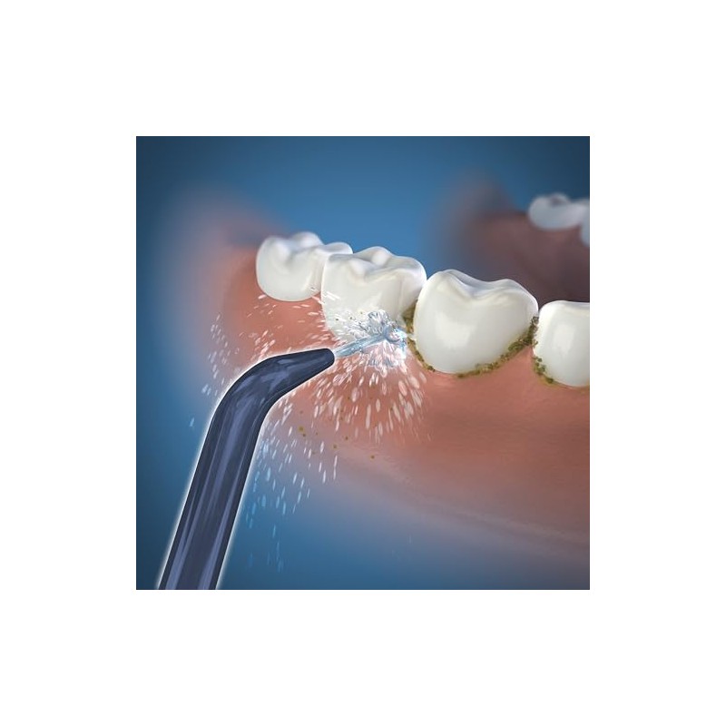 Waterpik Low-Pressure Jet Tip, JT-360E