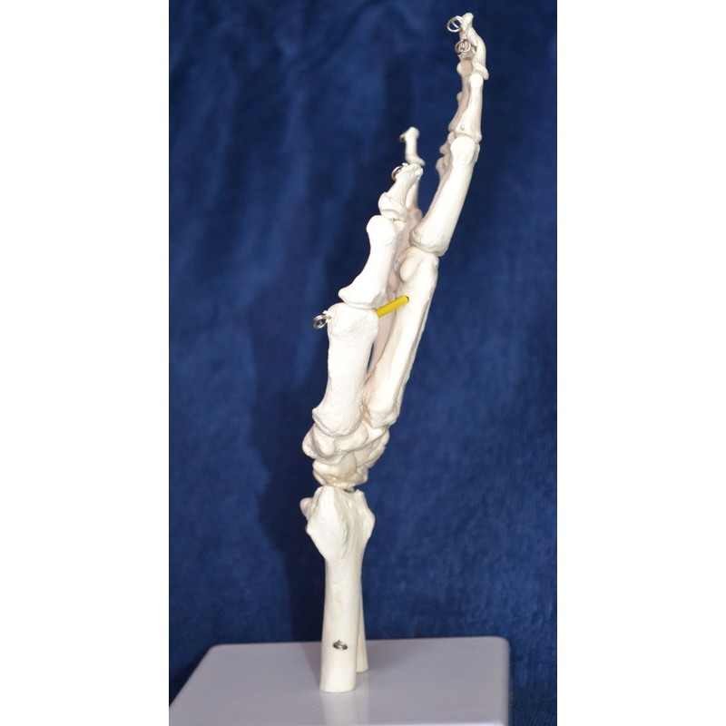Wellden Cranstein A-324 Hand Skeleton Anatomy Model