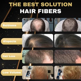 Salvathor Duran Hair Fibres 25g - Pack x3 (Hair Fiber + Applicator + Comb) - Hair Thickening Products - Hair Fibres for Thinning Hair - Hair Thickener Full Kit for Men and Women (Medium Brown)