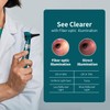 Scian Otoscope Ear Scope with Light, Fibre Optic Otoscopes with