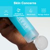 Paula's Choice CLEAR Regular Strength Anti-Redness Exfoliating Solution with 2%