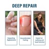 Advanced Nail Formula for Toenail and Fingernail - Nourishing and