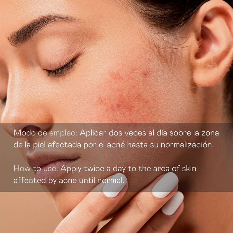 BULLON AntiAcne Directo 30 ml