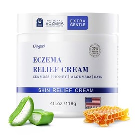 Crema natural calmante para eczema, miel y musgo marino, crema orgánica para aliviar el eczema, para rostro y cuerpo, reparación natural de piel seca 