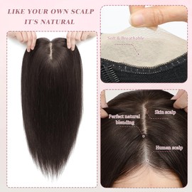 Hair Toppers for Thinning Hair Women Real Hair 16Inch Hair Toppers 7 * 7 Inch Skin Scalp Big Base Cover Thinning Hair or Hair Loss Top Hair Pieces Wiglets Remy Hair Topper Cover Large/scalp reality