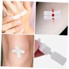 Healeved 1set Needle- Close Strips Strips Zip Band for Care