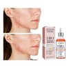 Set Dos Serum Facial 5 En 1 Reduce Poros Dilatados