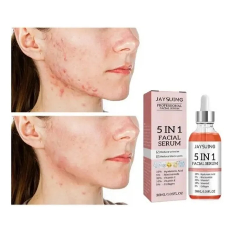 Set Dos Serum Facial 5 En 1 Reduce Poros Dilatados
