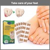 50 pieces toenail patch, toenail correction patch, corrector pedicure tools,