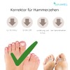 MEDOSAN Hammer Toe Corrector | Pack of 2 | Left