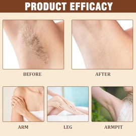 Cyperus Rotundus Oil Cyperus Oil Cyperus Rotundus Oil for Hair Removal Natural Cyperus Oil for Hair Removal Suitable for Inhibiting Hair Growth on the Body (60 ml)