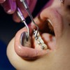 Healifty 30 Unids Base Redonda Botón Lingual Dental Metal Dentista
