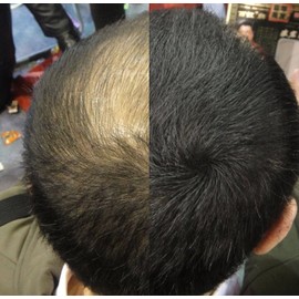 LDN Professional Hair Building Fibres for Hair Loss and Thin Hair, No.1 for Instantly Thickening Hair Naturally, 20g hair fiber bottle (Black)