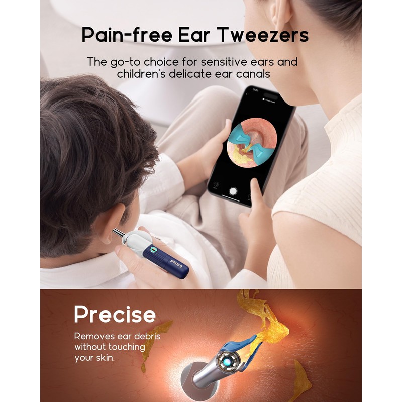 Bebird Pro Earwax Removal Kit with Flexible Otoscope Camera Light