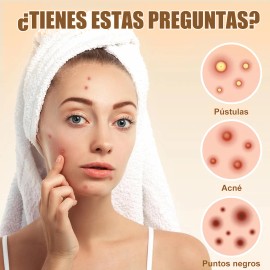 🔥 432pzs parches estrella star anti acne espinillas granos  Vitaminas y Minerales