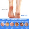 ElevateTech 4Pcs Pumice Stone for Feet, Foot Callus Remover Pedicure