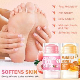 Fmnung 2PC Hydrating and Anti-Cracking Foot Cream, 2025 Upgraded Smooth Steps Foot Therapy Balm, Foot Cream for Dry Cracked Heels and Feet Women Men