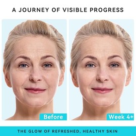 Crema Facial de Retinol con Colágeno y Ácido Hialurónico - Hidratante Facial Antienvejecimiento y Reafirmante para Mujeres y Hombres - Crema Antiarrug