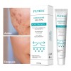 Gel Contra Barros Y Espinillas Tipo De Piel Con Acné,
