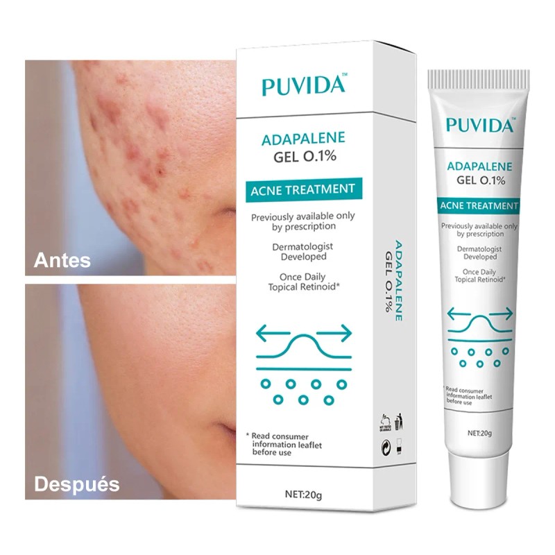 Gel Contra Barros Y Espinillas Tipo De Piel Con Acné,