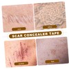 FOMIYES Skin Flaw Concealing Stickers Breathable Scar Tape for Birthmarks