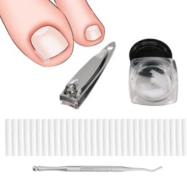 Eingewachsene Zehennägel Set,Ingrown Zehennagel Korrektur Set,50 Stück Schmerzfreie Zehennagelglättungsstreifen,Set zur Korrektur Eingewachsener Zehennägel,Zehennagel Korrektur Patch