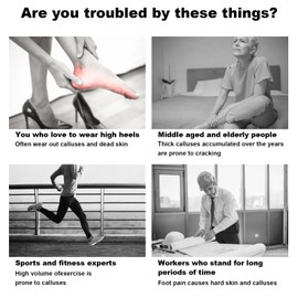 Electric Foot Callus Remover for Feet, Electric Foot File Callus Remover, Electric Foot Sanders for Feet, Electric Callus Remover for Feet, Foot Grinder with 60 Pcs Sandpaper Discs - Black