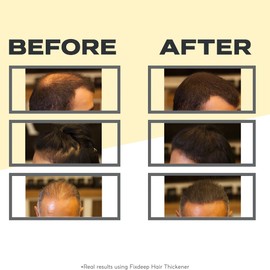 FIXDEEP Hair Thickener | New Waterproof Formula - Natural & Fuller Looking Hair in 30 sec - 14g - Fibers for Thinning, Bald Spots & Graying Roots (Dark Brown)