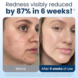 CLEAN SKIN CLUB Clean Skin Club Clean Towels XL Travel, paquete de 3 Toallas faciales 100% biobasadas aprobadas por dermatólogos certificadas por USDA