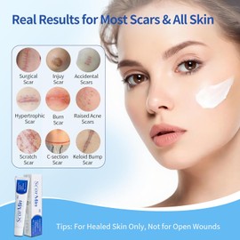 Gel de silicona para cicatrices de grado médico HBM, crema avanzada para eliminar cicatrices antiguas y recientes, estrías, cicatrices quirúrgicas, queloides, acné, cesáreas y quemad