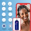 Mediceuticals Therapro X-Derma Champú para tratamiento de piel cabelludo seco