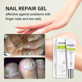 2PCs Efero Nail Treatment Repair Gel, Nail Repair Cream, Nail Repair Essence Gel, Toe Be Health Instant Beauty Gel, Toenail Treatment & Care Under the Nail, Restores Discolored or Damaged Nails